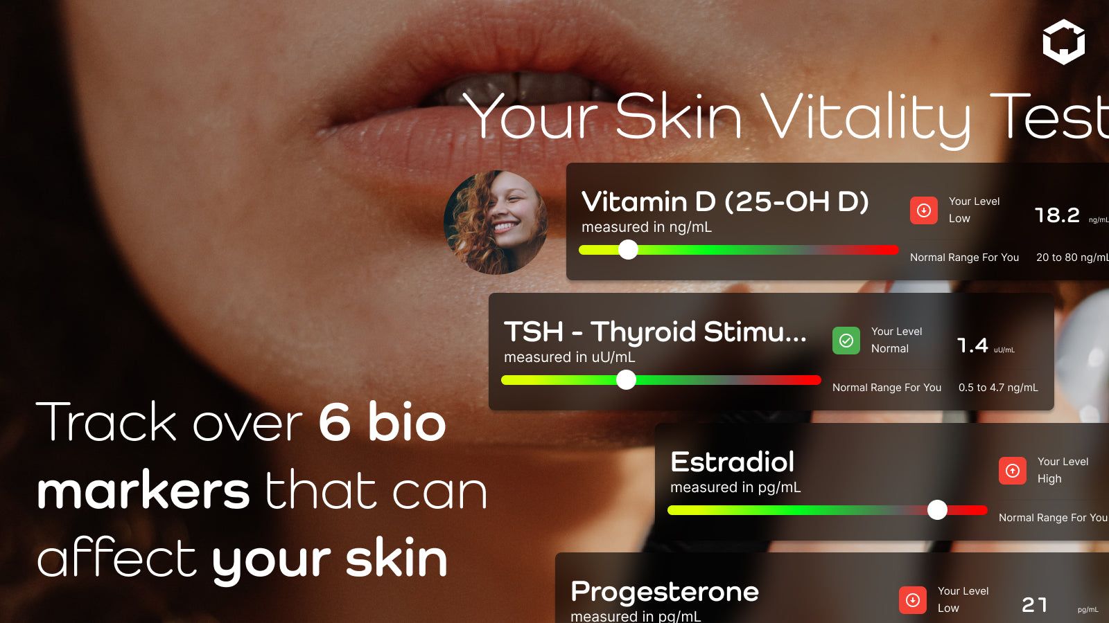 Skin Test Example